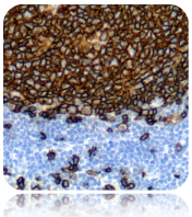 CD20, B-Cell; Clone L26