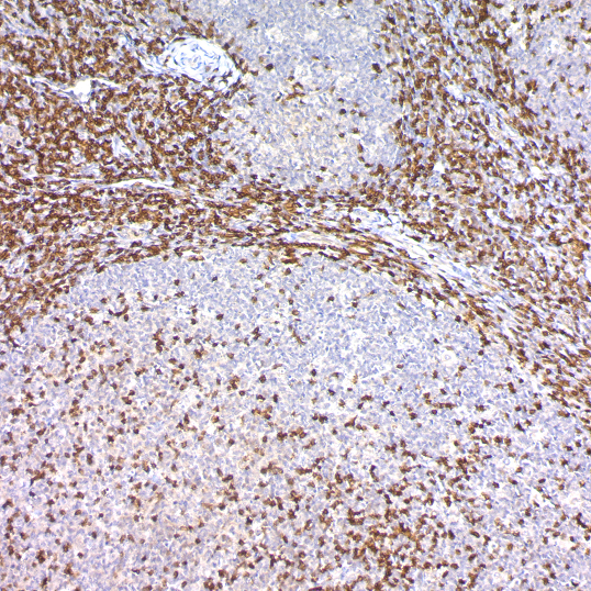 CD3, T-Cell; Polyclonal (Ready-To-Use)