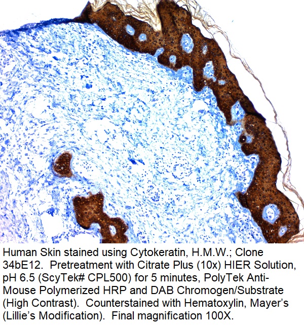 Cytokeratin, High Molecular Weight; Clone 34bE12 (Ready-To-Use)