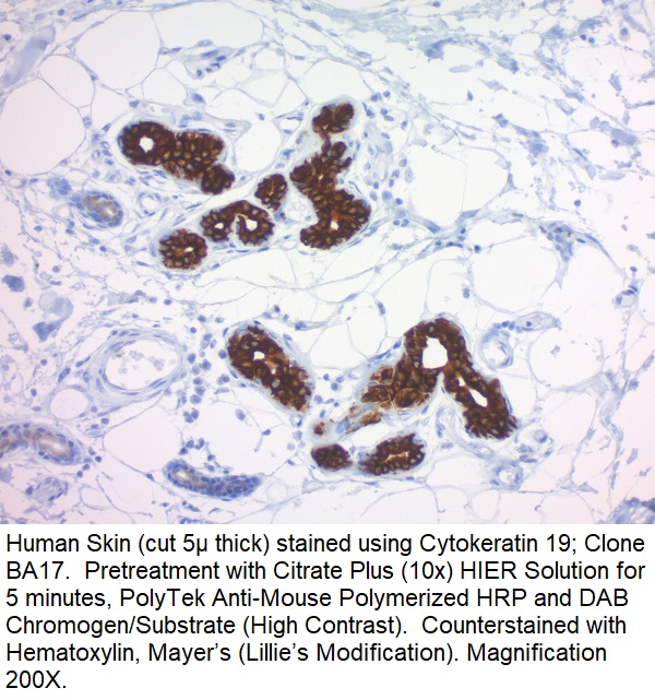 Cytokeratin 19; Clone BA17 (Ready-To-Use)