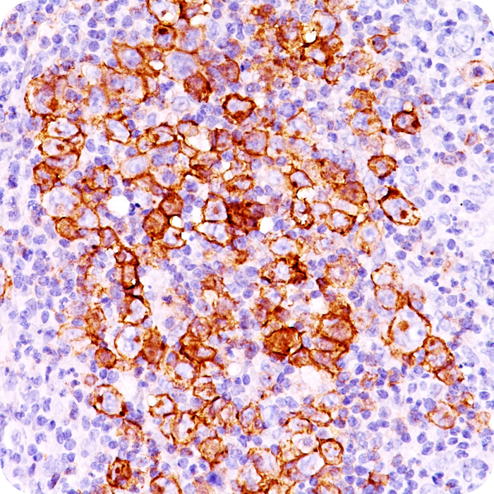 CD30 / TNFRSF8 (Hodgkin & Reed-Sternberg Cell Marker); Clone CD30/412 (Concentrate)