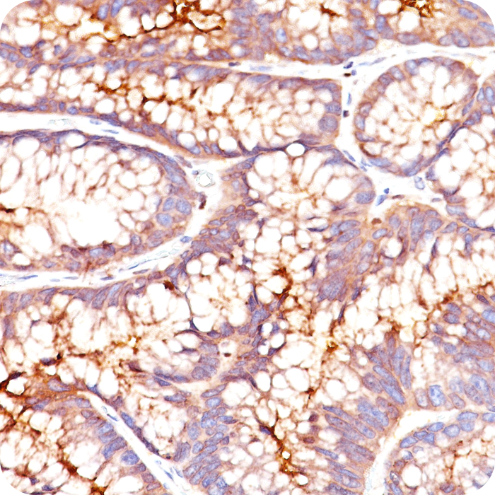 Carcinoembryonic Antigen (CEA) / CD66; Clone CEA31 (Concentrate)