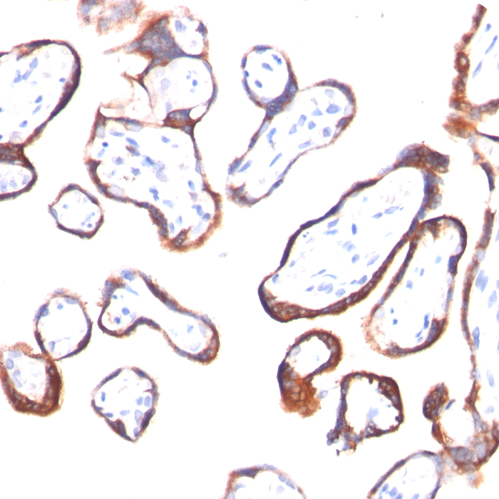 hCG-beta (Pregnancy & Choriocarcinoma Marker); Clone HCGb/54 (Concentrate)