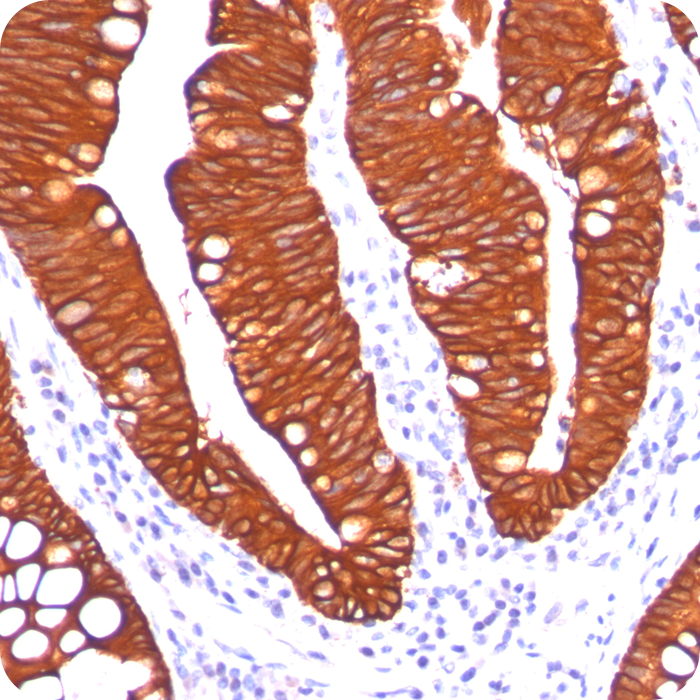 Cytokeratin 19 (KRT19) (Pancreatic Stem Cell Marker); Clone A53-B/A2.26 (Ks19.1) (Concentrate)