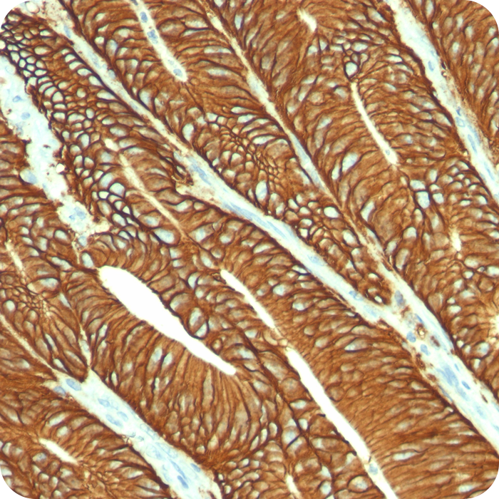 Ep-CAM / CD326 (Epithelial Marker); Clone VU-1D9 (Concentrate)