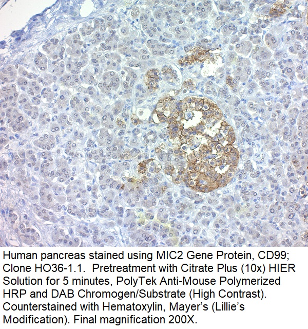 CD99 / MIC2 (Ewing's Sarcoma Marker); Clone HO36-1.1 (Concentrate)
