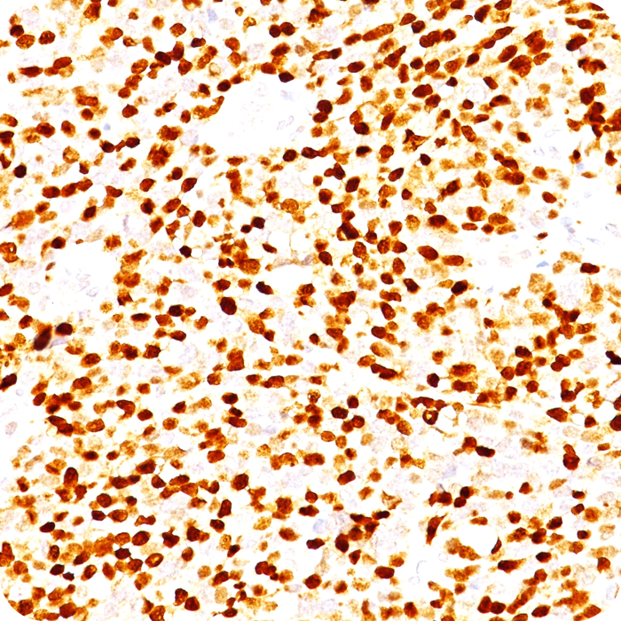 MyoD1 (Rhabdomyosarcoma Marker); Clone MYD712 (Concentrate)