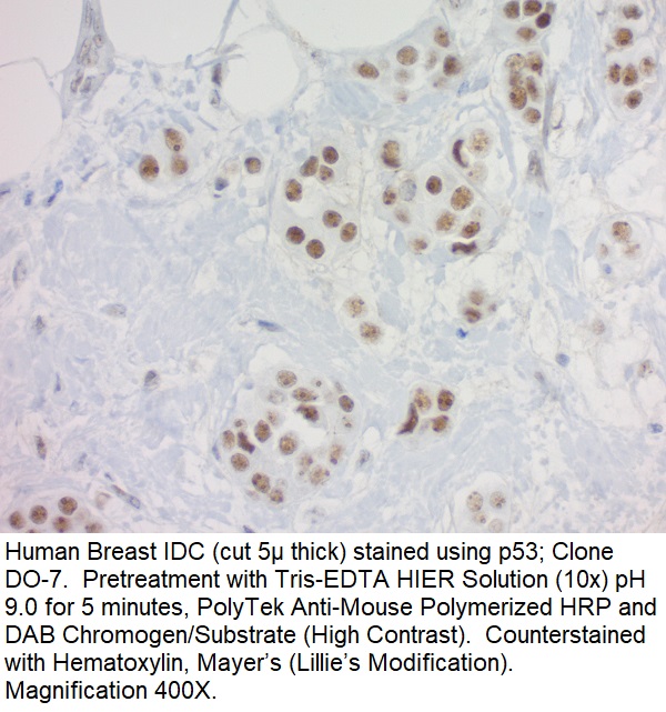 p53 Tumor Suppressor Protein; Clone DO-7 (Concentrate)
