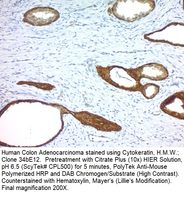 Cytokeratin, Basic (Type II or HMW) (Epithelial Marker); Clone 34BE12 (Concentrate)