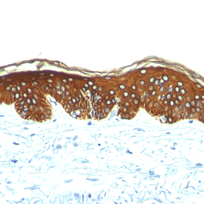Cytokeratin, Basic (Type II or HMW) (Epithelial Marker); Clone AE-3 (Concentrate)