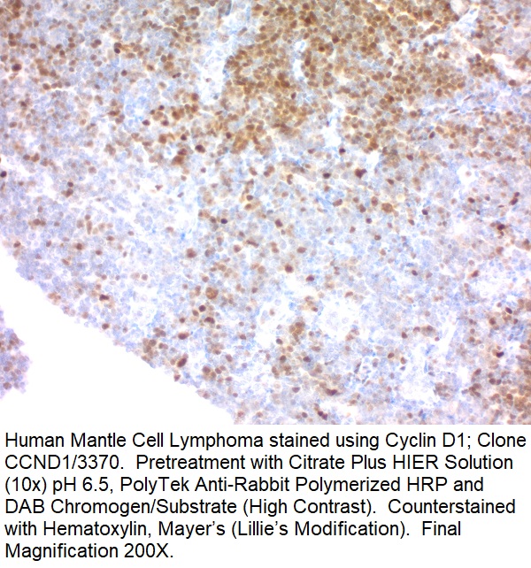 Cyclin D1 (G1-Cyclin & Mantle Cell Lymphoma Marker); Clone CCND1/3370R (Concentrate)