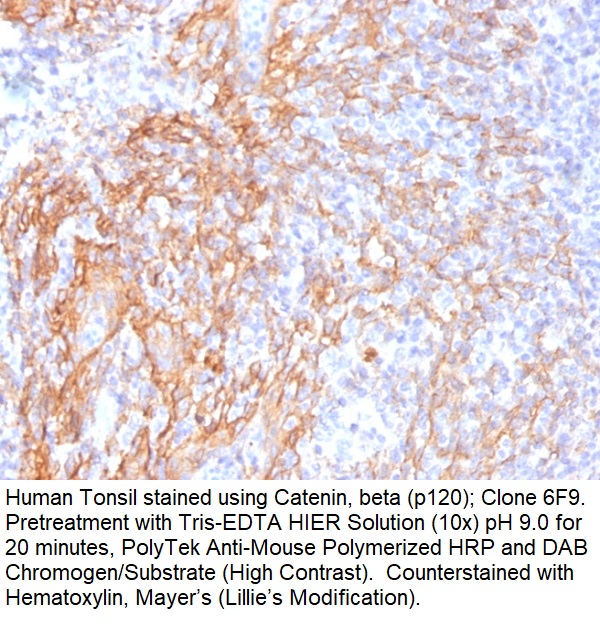 Catenin, beta (p120); Clone 6F9 (Concentrate)