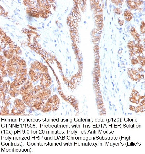Catenin, beta (p120); Clone CTNNB1/1508 (Concentrate)