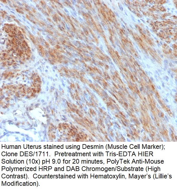 Desmin (Muscle Cell Marker); Clone DES/1711 (Concentrate)