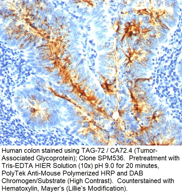 TAG-72 / CA72.4 (Tumor-Associated Glycoprotein); Clone SPM536 (Concentrate)