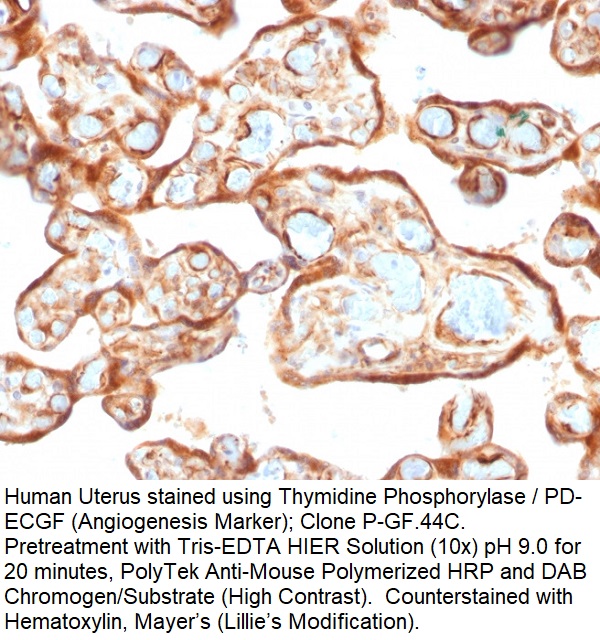 Thymidine Phosphorylase / PD-ECGF (Angiogenesis Marker); Clone P-GF.44C (Concentrate)