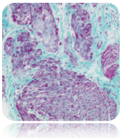 Trichrome Stain Solution (Green)