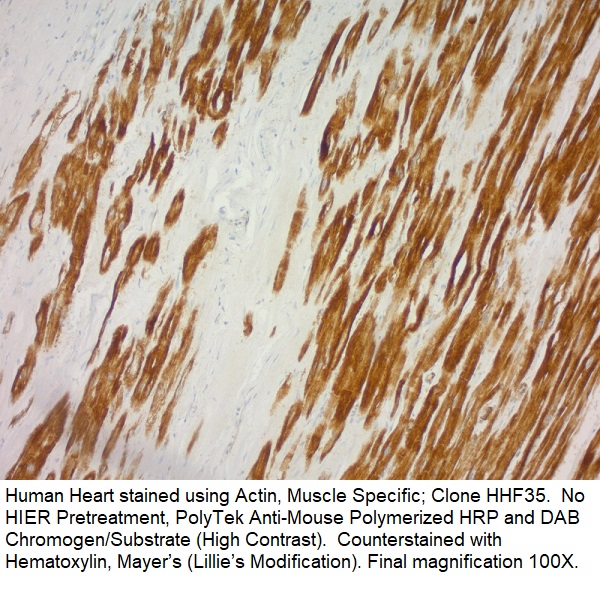 Actin, Muscle Specific; Clone HHF35 (Ready-To-Use)