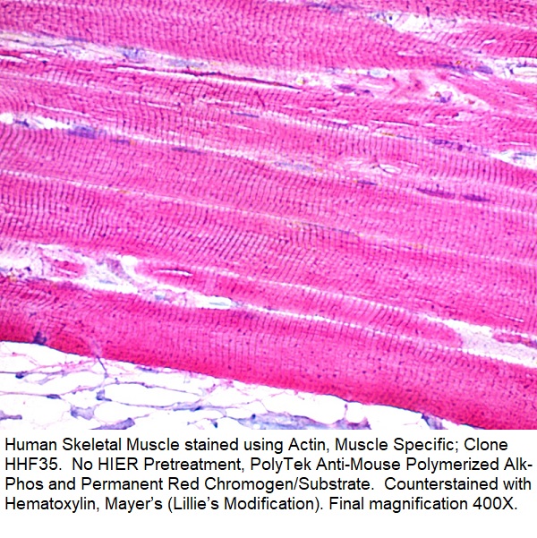 Actin, Muscle Specific; Clone HHF35 (Ready-To-Use)