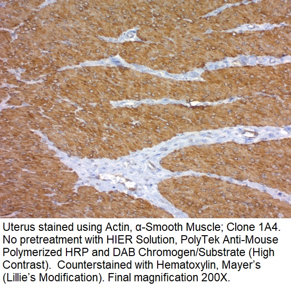 Actin, Alpha-Smooth Muscle; Clone 1A4 (Ready-To-Use)