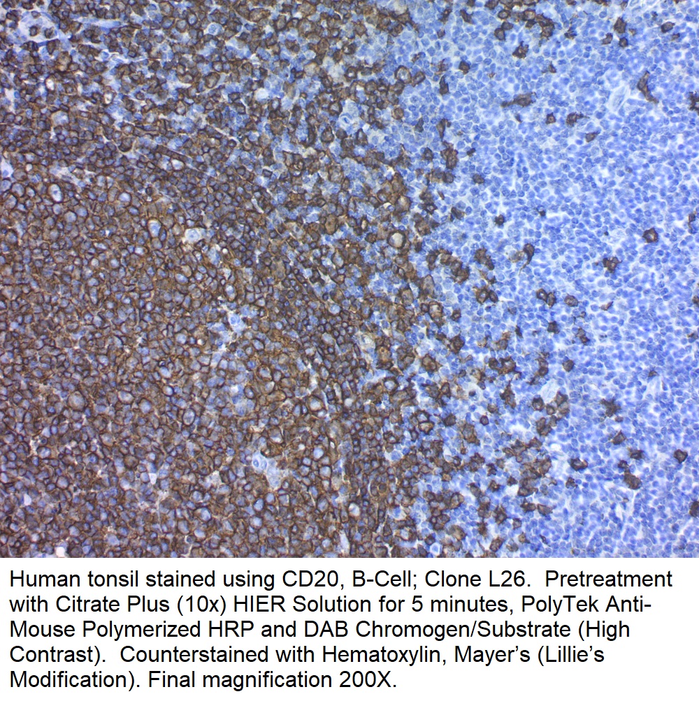 CD20, B-Cell; Clone L26 (Concentrate)