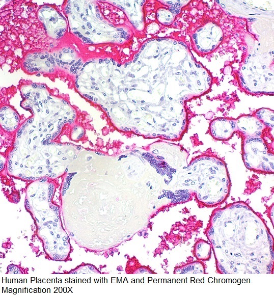 Epithelial Membrane Antigen; Clone E29 (Ready-To-Use)