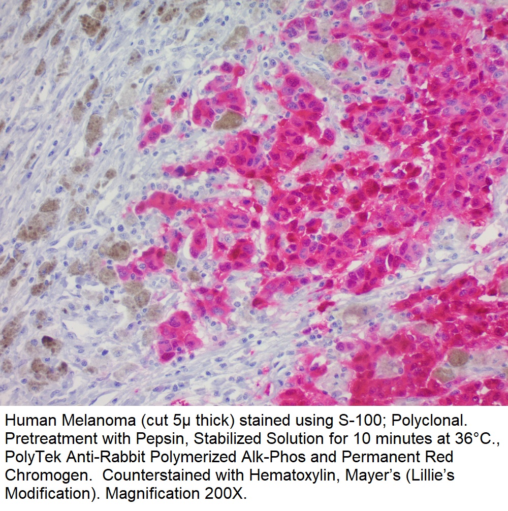 S-100; Polyclonal (Ready-To-Use)