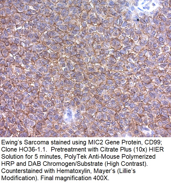 MIC2 Gene Protein, CD99; Clone HO36-1.1 (Ready-To-Use)