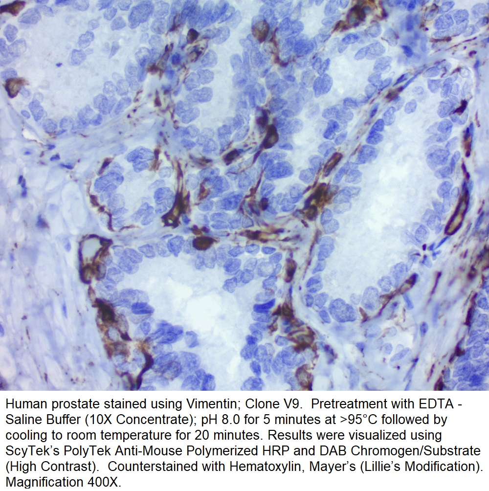 Vimentin; Clone V9 (Concentrate)