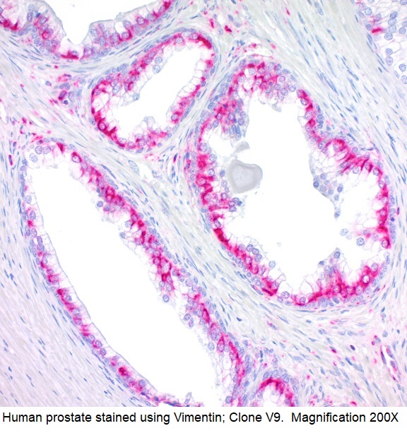 Vimentin; Clone V9 (Ready-To-Use)