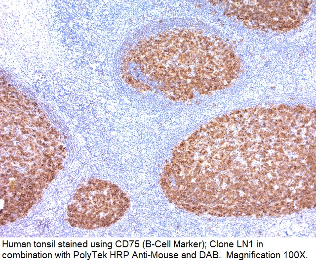 CD75 (B-Cell Marker); Clone LN1 (Ready-To-Use)