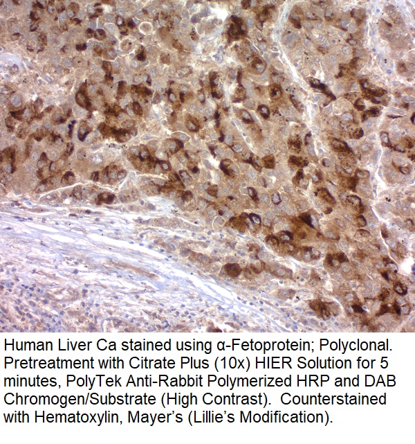 Alpha-1-Fetoprotein (AFP); Polyclonal (Ready-To-Use)