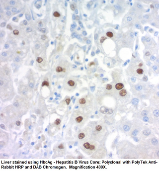 Hepatitis B Core Antigen (HBcAg); Polyclonal (Ready-To-Use)