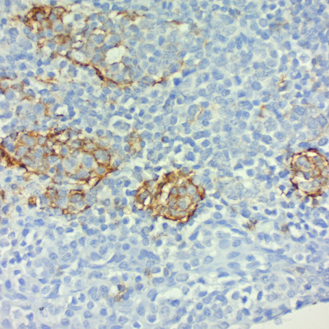 CD23, B-Cell; Clone MHM6