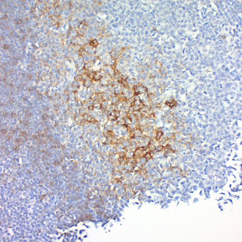 CD23, B-Cell; Clone MHM6