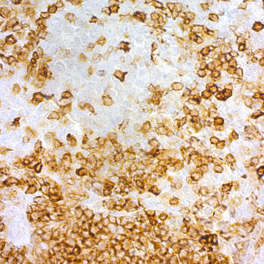 CD5 (Mantel Cell Lymphoma Marker); 4C7
