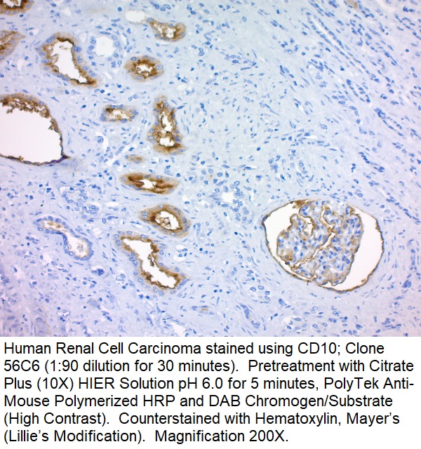 CD10, CALLA (Neutral Endopeptidase); Clone 56C6 (Concentrate)
