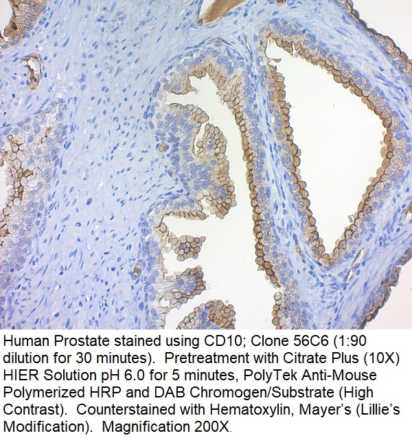 CD10, CALLA (Neutral Endopeptidase); Clone 56C6 (Concentrate)