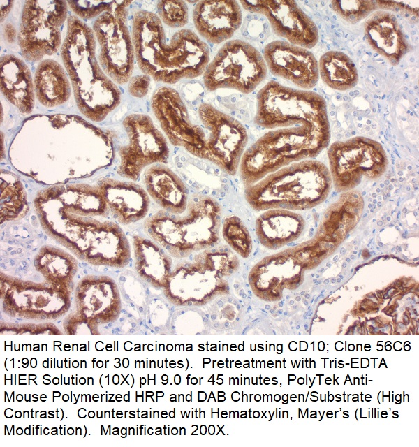 CD10, CALLA (Neutral Endopeptidase); Clone 56C6 (Concentrate)