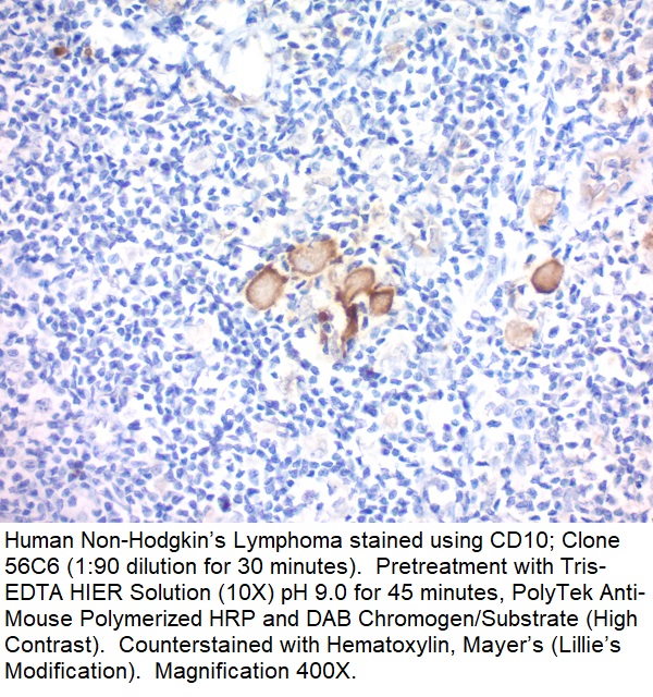 CD10, CALLA (Neutral Endopeptidase); Clone 56C6 (Concentrate)