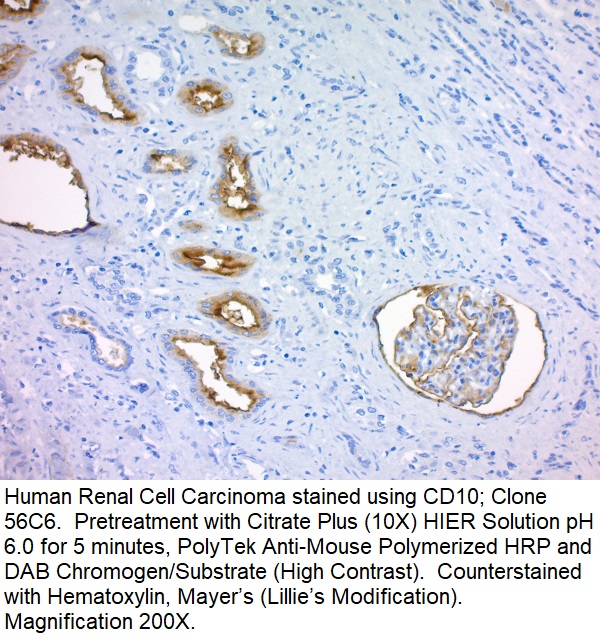 CD10, CALLA (Neutral Endopeptidase); Clone 56C6 (Ready-To-Use)