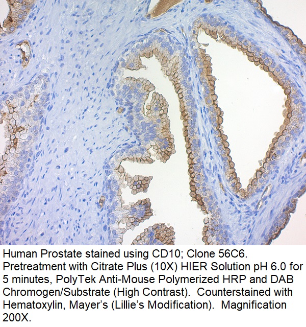 CD10, CALLA (Neutral Endopeptidase); Clone 56C6 (Ready-To-Use)