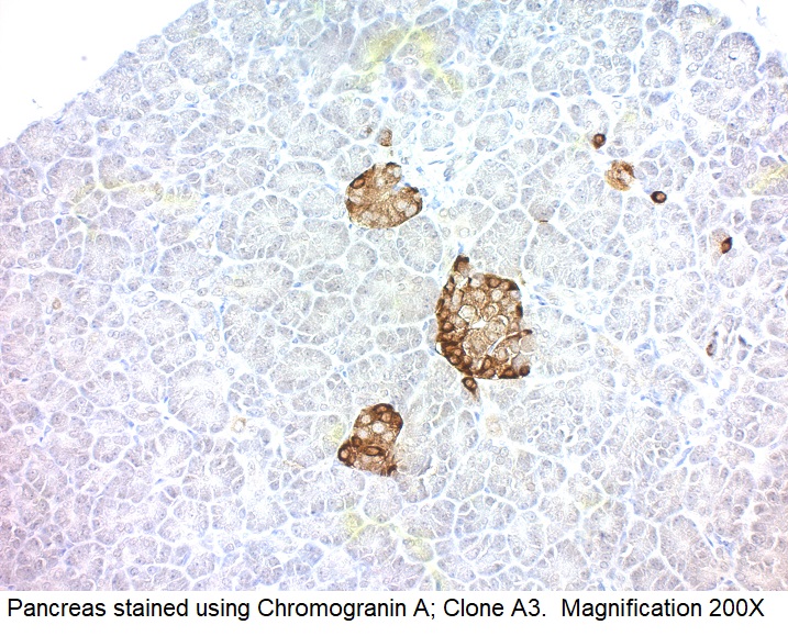 Chromogranin A; Clone A3