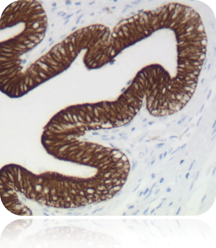 Cytokeratin (Pan); Clone Cocktail (Ready-To-Use)