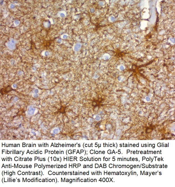 Glial Fibrillary Acidic Protein (GFAP); Clone GA-5 (Ready-To-Use)