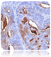 CA19-9; Clone 121SLE (Ready-To-Use)