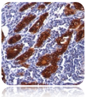 Thyroglobulin; Clone 2H11 (Concentrate)