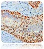 p40 (DeltaNp63); Polyclonal (Concentrate)