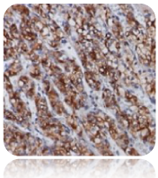 Renal Cell Carcinoma (RCC); Clone 66.4.C2 (Ready-To-Use)
