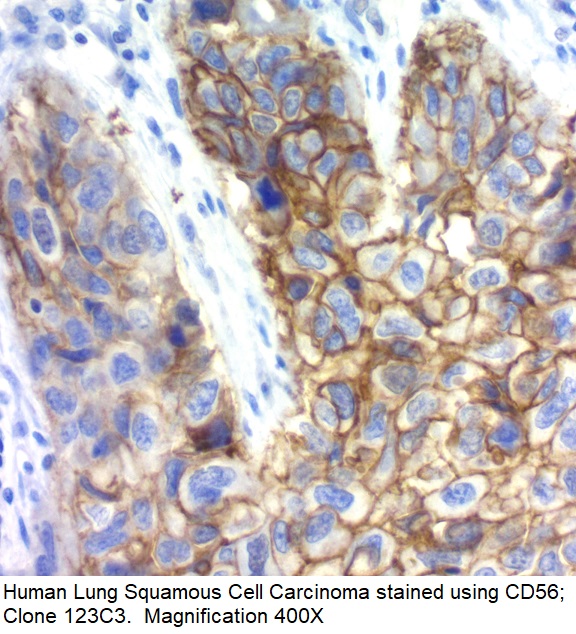 CD56; Clone 123C3 (Concentrate)